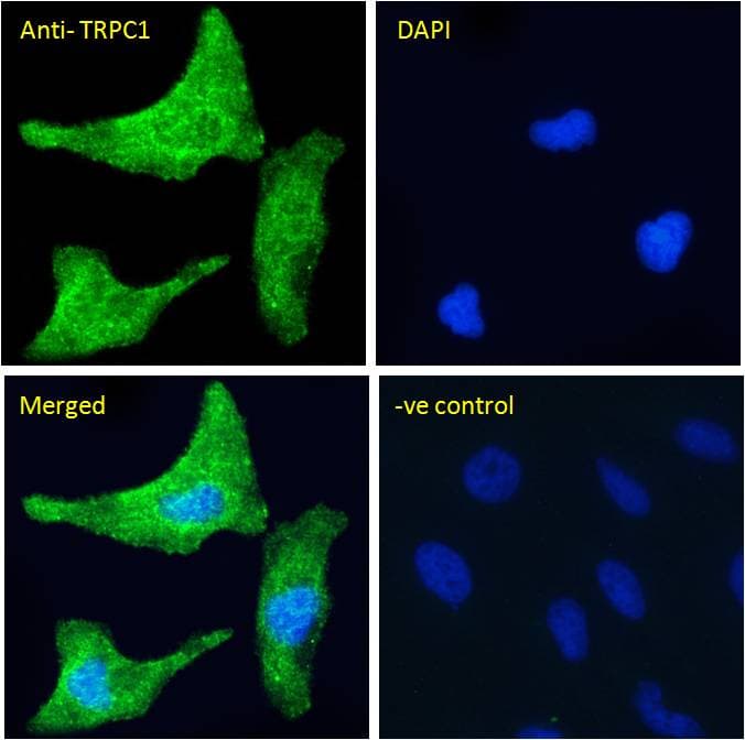 IHC-plus™ TRPC1 Antibody (aa722-733)