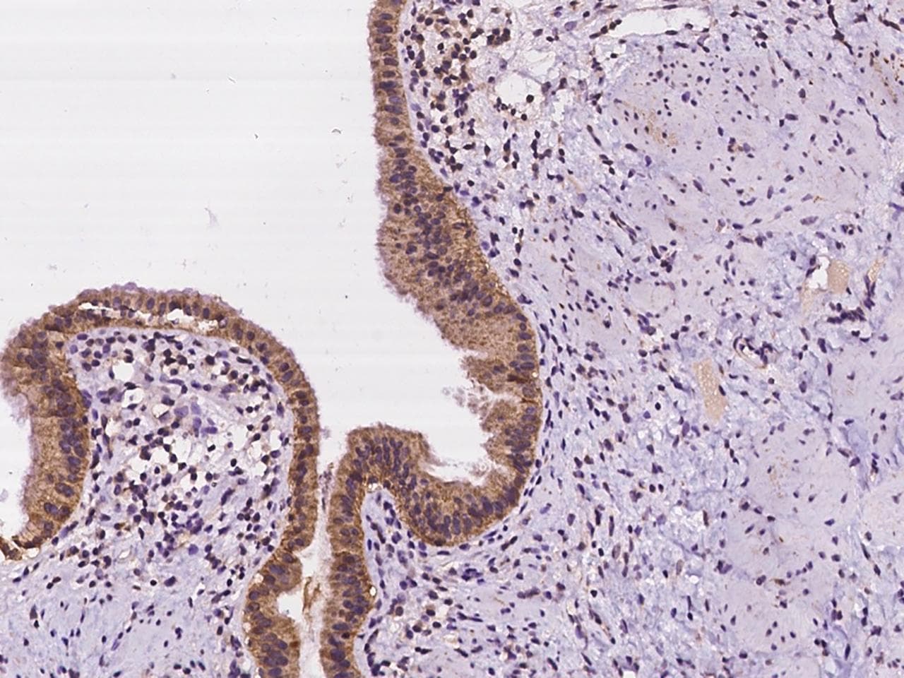 Polyclonal Rabbit anti-Human CLDN10 / Claudin 10 Antibody (IHC)