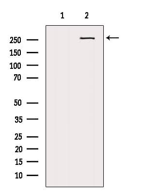 Polyclonal Rabbit anti-Human CSPG4 / NG2 Antibody (IHC, IF, WB)
