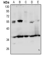 Polyclonal Rabbit anti-Human GRTP1 Antibody (IHC, WB)