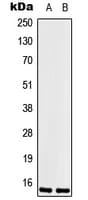 LSM1 Antibody (Internal)
