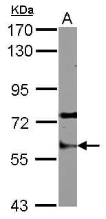 Polyclonal Rabbit anti-Human STAU1 / Staufen Antibody (IHC, WB)