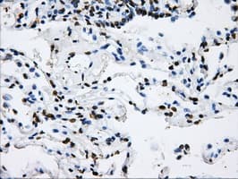 LOX / Lysyl Oxidase Antibody (clone OTI8G5)