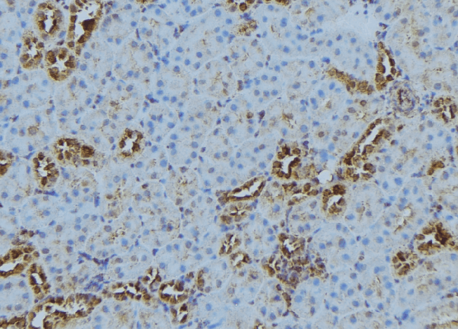 Polyclonal Rabbit anti-Human CTSS / Cathepsin S Antibody (IHC, WB)