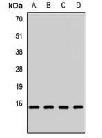 Polyclonal Rabbit anti-Human FAU / Fub1 Antibody (WB)