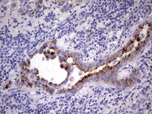 GBA / Glucosidase Beta Acid Antibody (aa40-315, clone OTI2C12)