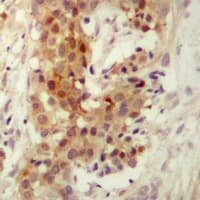 PKC Iota + PKC Zeta Antibody (Internal)
