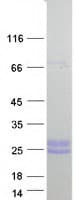 Human COL10A1 / Collagen X Protein (Recombinant Myc-DDK (Flag))
