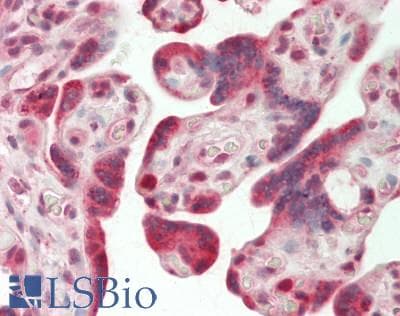 IHC-plus™ Polyclonal Rabbit anti-Human TNFAIP1 Antibody (IHC, IF, WB)