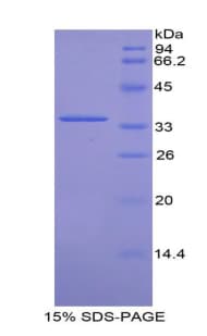 Mouse CDK4 Protein (Recombinant His)