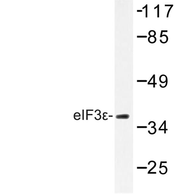 Polyclonal Rabbit anti-Human EIF3S5 / EIF3F Antibody (Val116, IHC, WB)