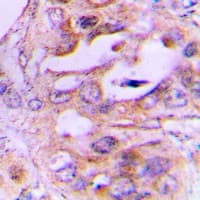 Polyclonal Rabbit anti-Human NDRG2 Antibody (Internal, IHC, WB)
