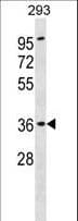 IHC-plus™ Polyclonal Rabbit anti-Human ATP6AP2 / Renin Receptor Antibody (aa205-234, IHC, WB)