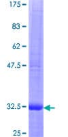 Human CCL3 / MIP-1-Alpha Protein (Recombinant GST)