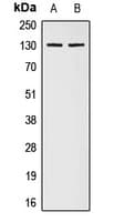 COL1A2 / Collagen I Alpha 2 Antibody (Internal)