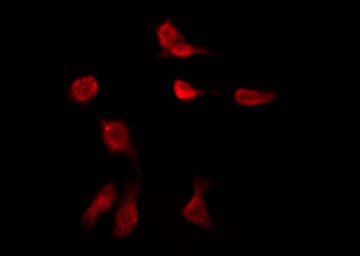 Polyclonal Rabbit anti-Human GPR149 / PGR10 Antibody (IF, WB)