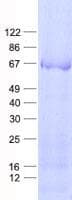 Human KRT84 / Keratin 84 / KRTHB4 Protein (Recombinant His, N-Terminal)