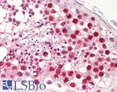 IHC-plus™ DUT / DUTPase Antibody