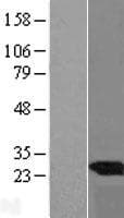 UBE2E3 Protein (Over-Expression Lysate Myc-DDK (Flag))