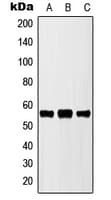 IHC-plus™ CYP2D6 Antibody (Internal)