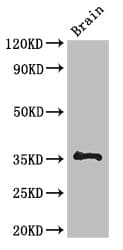 NPL / C112 Antibody