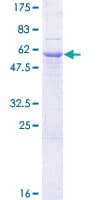 Human SGCG / Gamma-Sarcoglycan Protein (Recombinant GST)