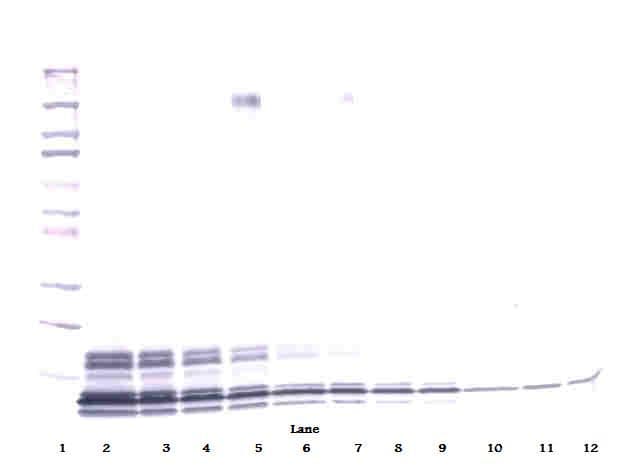 IHC-plus™ Polyclonal Rabbit anti-Human CXCL7 / PPBP Antibody (IHC, WB)