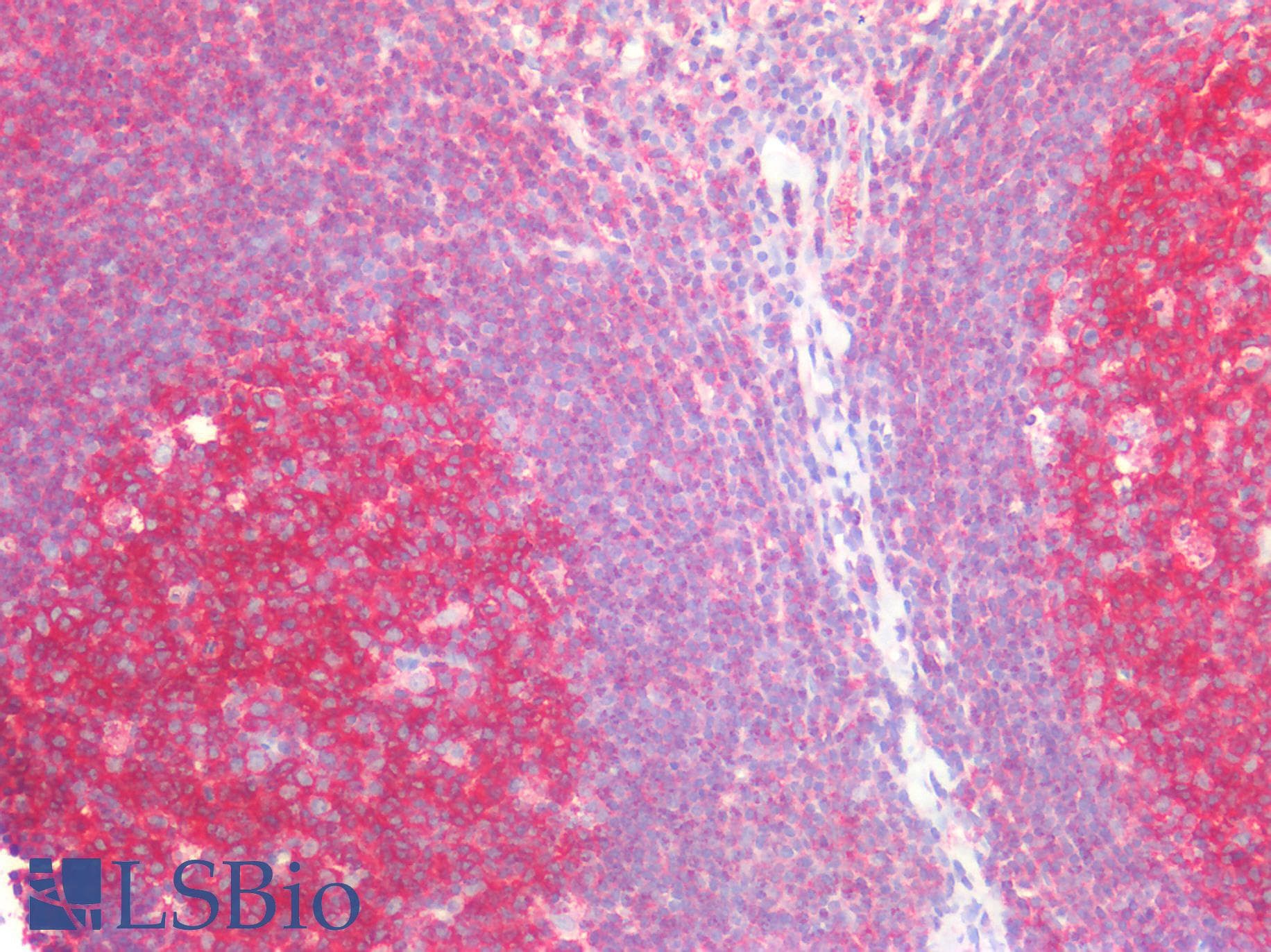 PathPlus™ SNAP23 / SNAP-23 Antibody