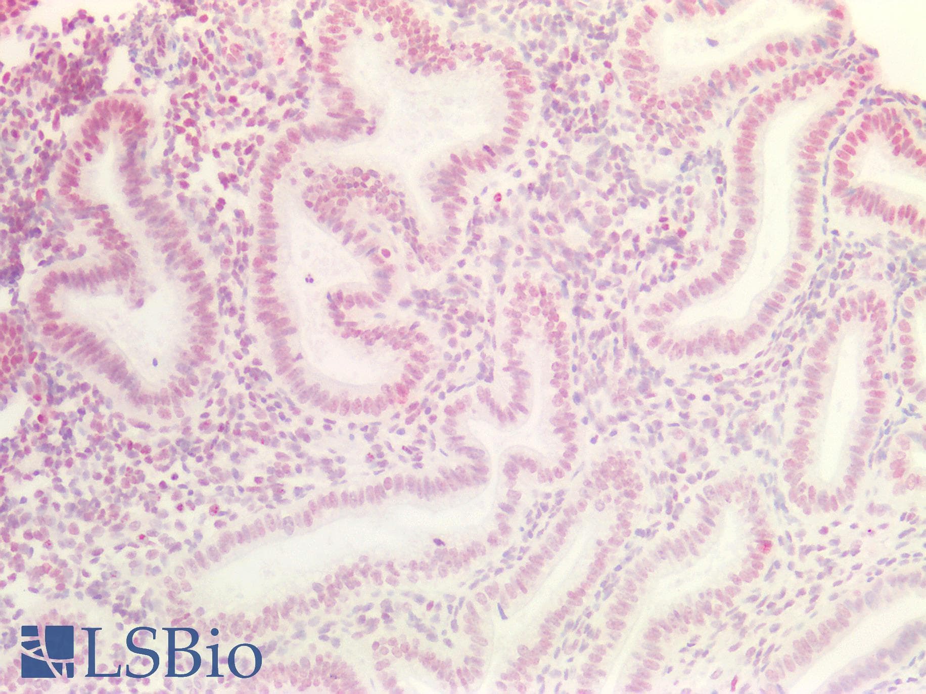 PathPlus™ MAX Antibody (aa147-160)