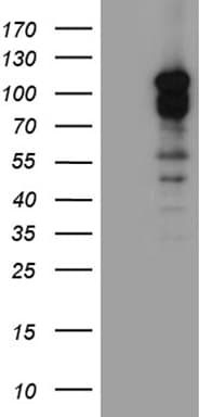 DLGAP3 / SAPAP3 Antibody (aa794-902, clone OTI5F10, Carrier-free)