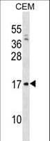 VPREB1 / CD179A Antibody (aa71-99)