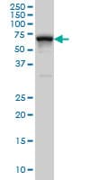 Monoclonal Mouse anti-Human RBM39 Antibody (clone 4G8, IHC, IF, WB)