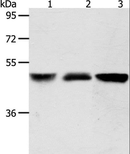 Polyclonal Rabbit anti-Human ACOT9 Antibody (WB)