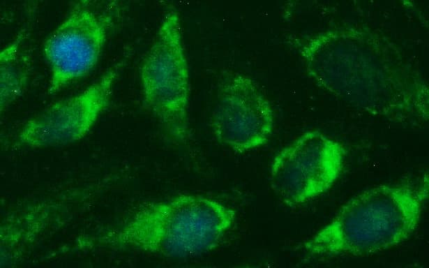 CEP68 Antibody (clone OTI1F6)