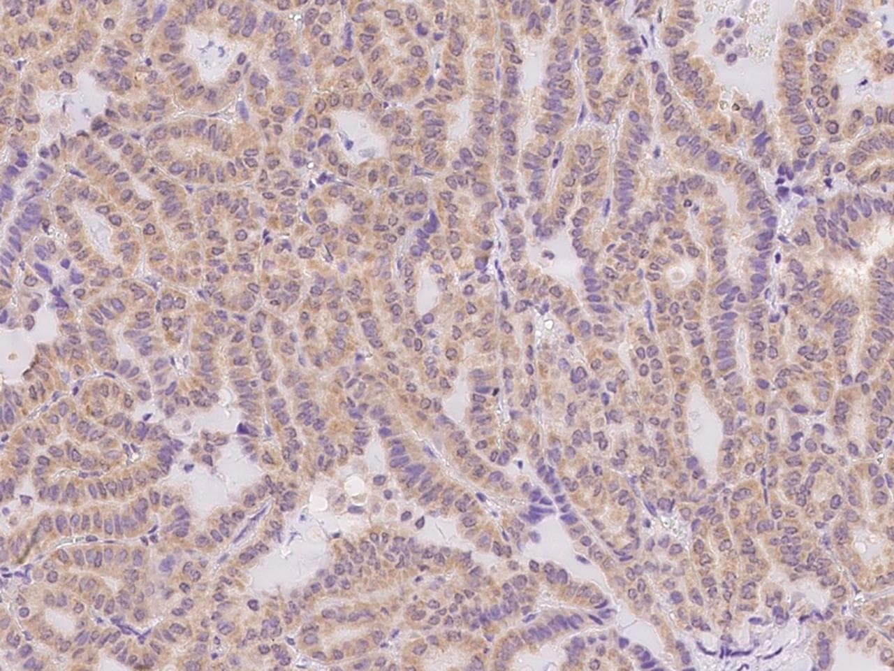 IL12RB1 / CD212 Antibody