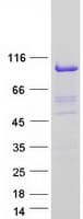Human NCBP1 / CBP80 Protein (Recombinant Myc-DDK (Flag))