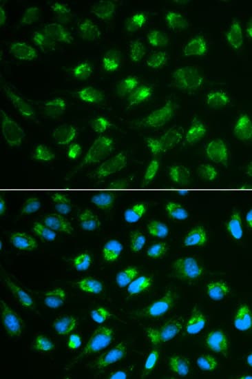 IHC-plus™ IL7 Antibody