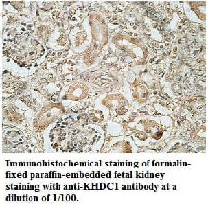 KHDC1 / C6orf148 Antibody (aa28-158)