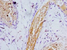 PSEN1 / Presenilin 1 Antibody (aa1-160)