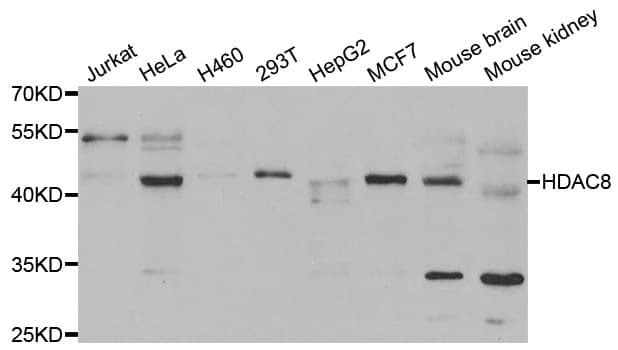 Polyclonal Rabbit anti-Human HDAC8 Antibody (IHC, WB)