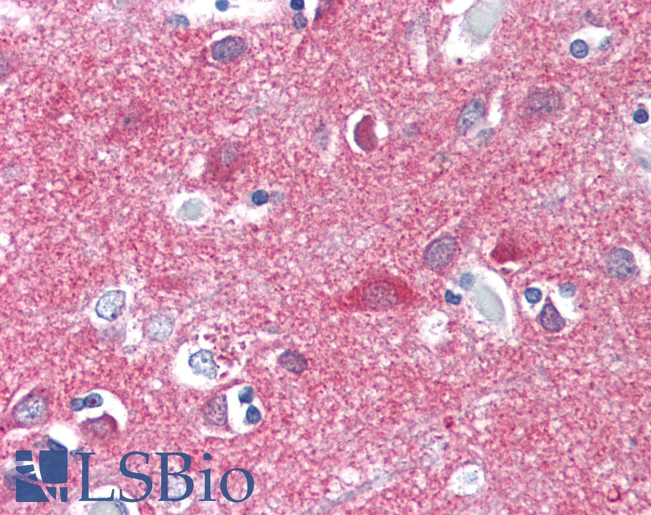 IHC-plus™ Polyclonal Rabbit anti-Human CNR1 / CB1 Antibody (aa1-99, IHC, WB)