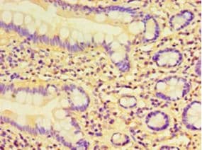 CCBL1 Antibody (aa1-372)