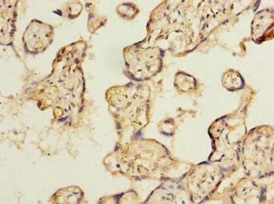 Polyclonal Rabbit anti-Human TSSC1 Antibody (IHC)