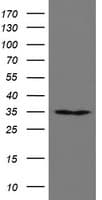 RBPMS / Hermes Antibody (clone OTI3D10)
