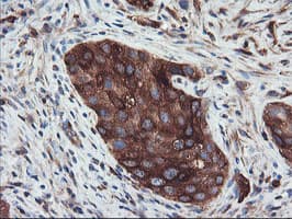 PFKP Antibody (clone OTI3H8)