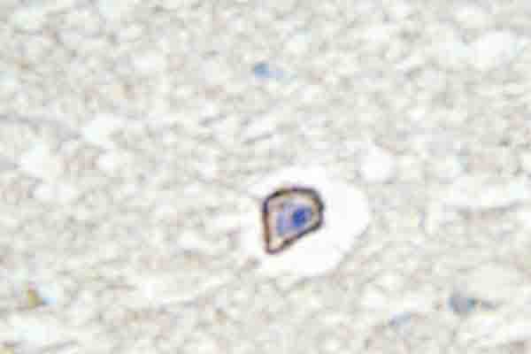 Polyclonal Rabbit anti-Human MRC2 / Endo180 Antibody (Gly145, IHC, WB)