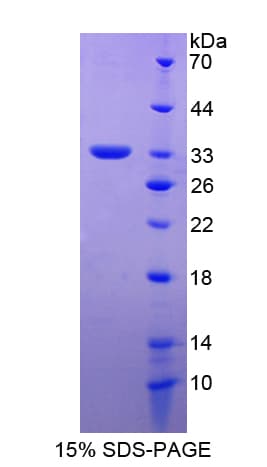 Human APBA2 Protein (Recombinant His-T7)