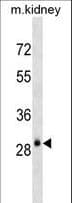 IHC-plus™ AQP3 / Aquaporin 3 Antibody (aa163-191)