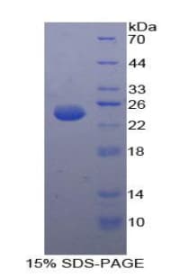 Human cPLA2 Protein (Recombinant His)