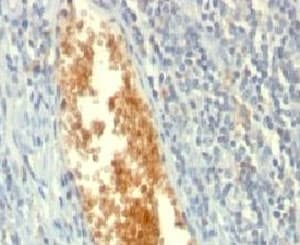 AMPD3 Antibody (clone AMPD3/901)